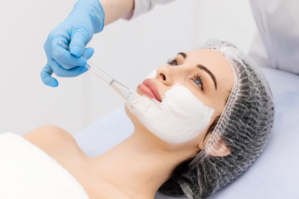 Chemical Peels Los Angeles