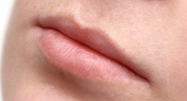 Lips before